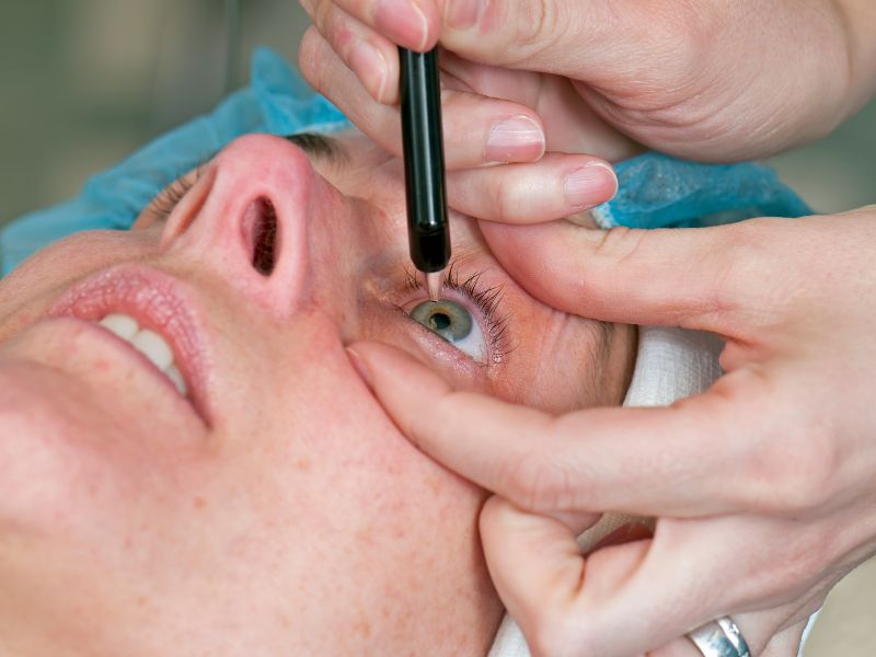 LASIK Surgery - Surgical Procedures That Can Greatly Benefit Your Life